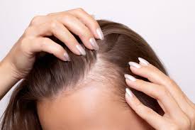 Why Am I Losing My Hair? The Most Common Causes Explained