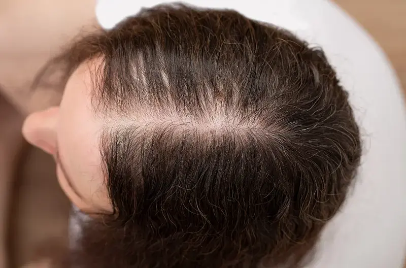 Hair Health
